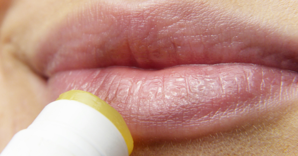 Is Vitamin E Good for Your Lips?